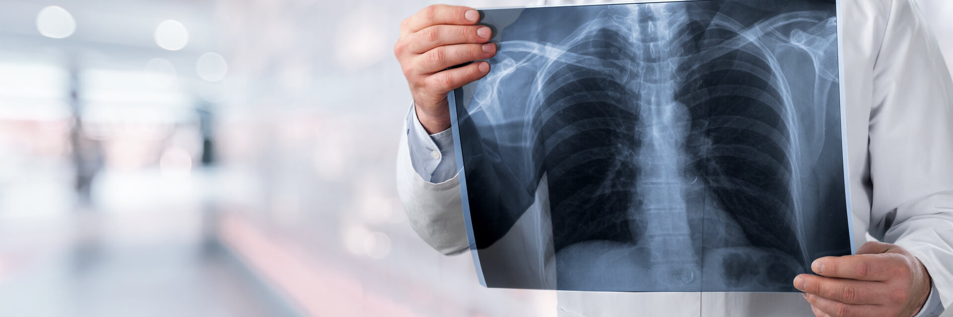 radiology doctor examining at chest x ray film of patient at hospital room