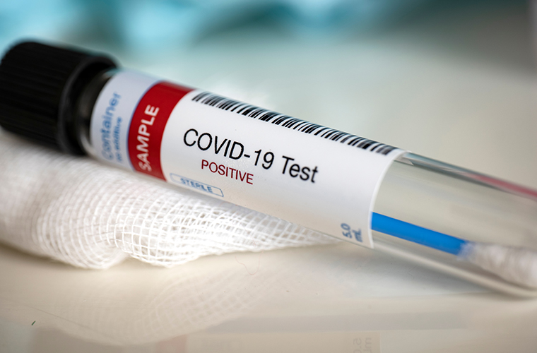 Covid-19 Lab Test