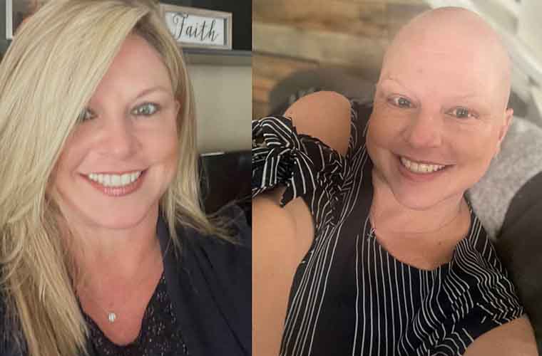 Split photo. Left, Liz with long, flowing blonde hair. Right, a bald Liz.