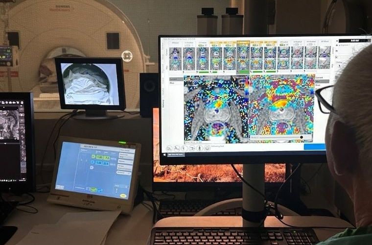 Physician analyzing colorful scan images on computer monitors in a medical imaging room.
