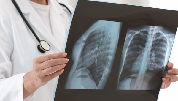 Doctor reviewing an Xray