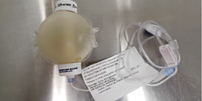 Elastomeric Pump